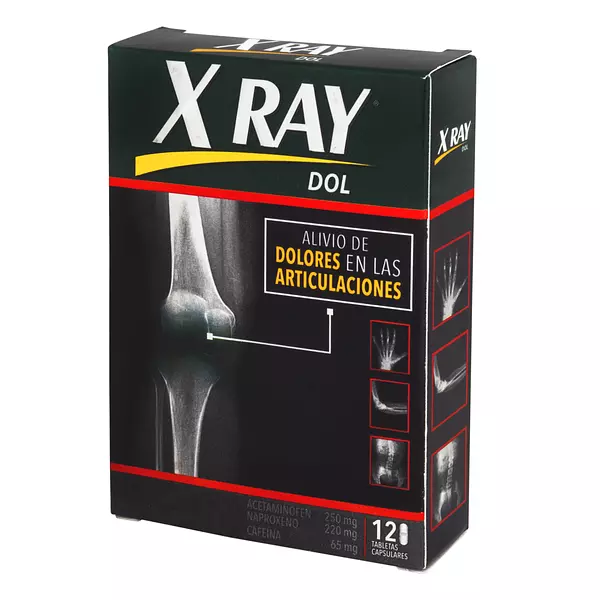 X Ray Dol