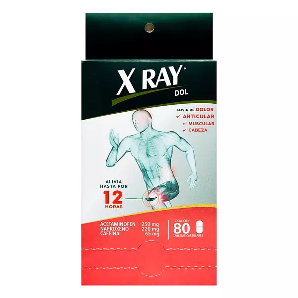 X Ray Dol