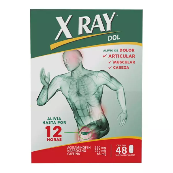 X Ray Dol