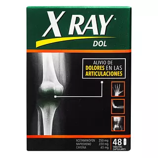 X Ray Dol